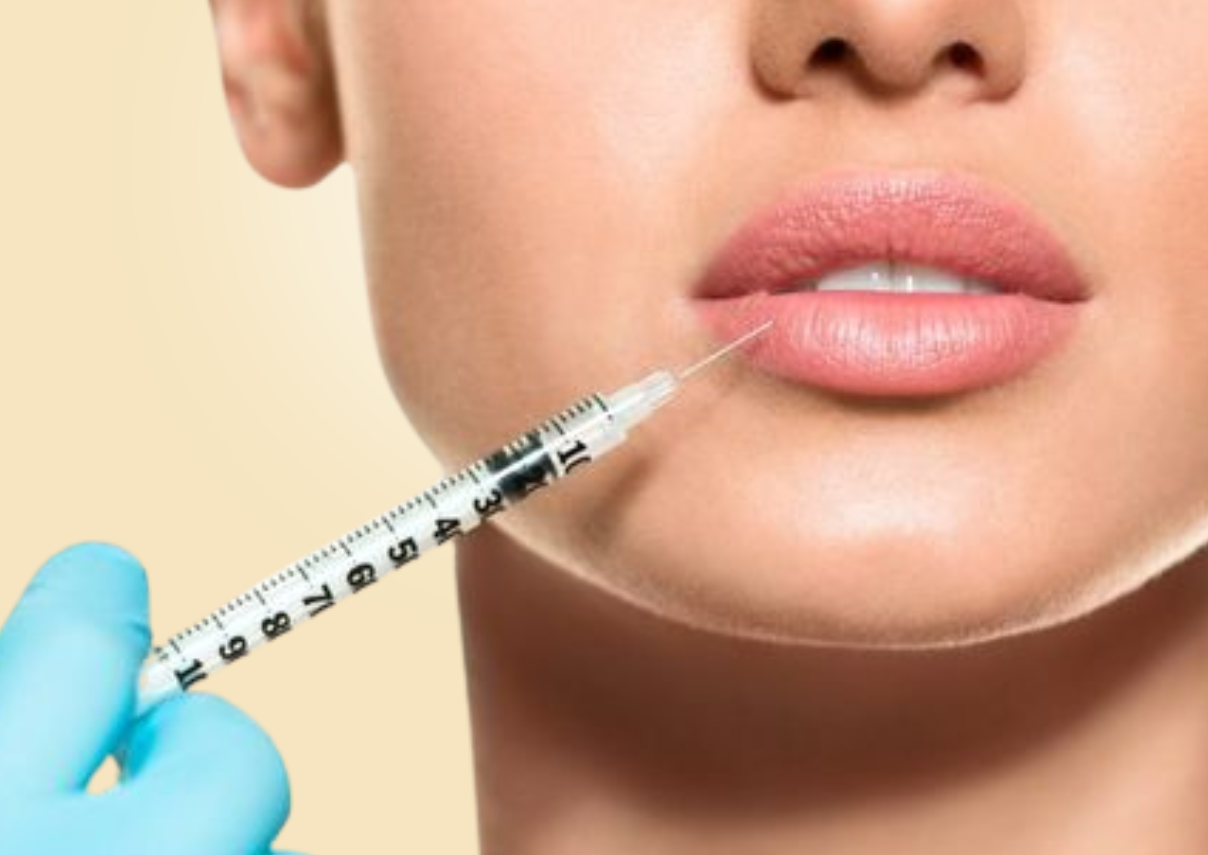 Lip Augmentation Fillers